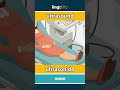 ultrasound - ultrasonido video thumbnail