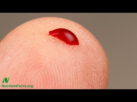 Kohl ist schädlich für Diabetiker Manifesten Diabetes bei einem Kind