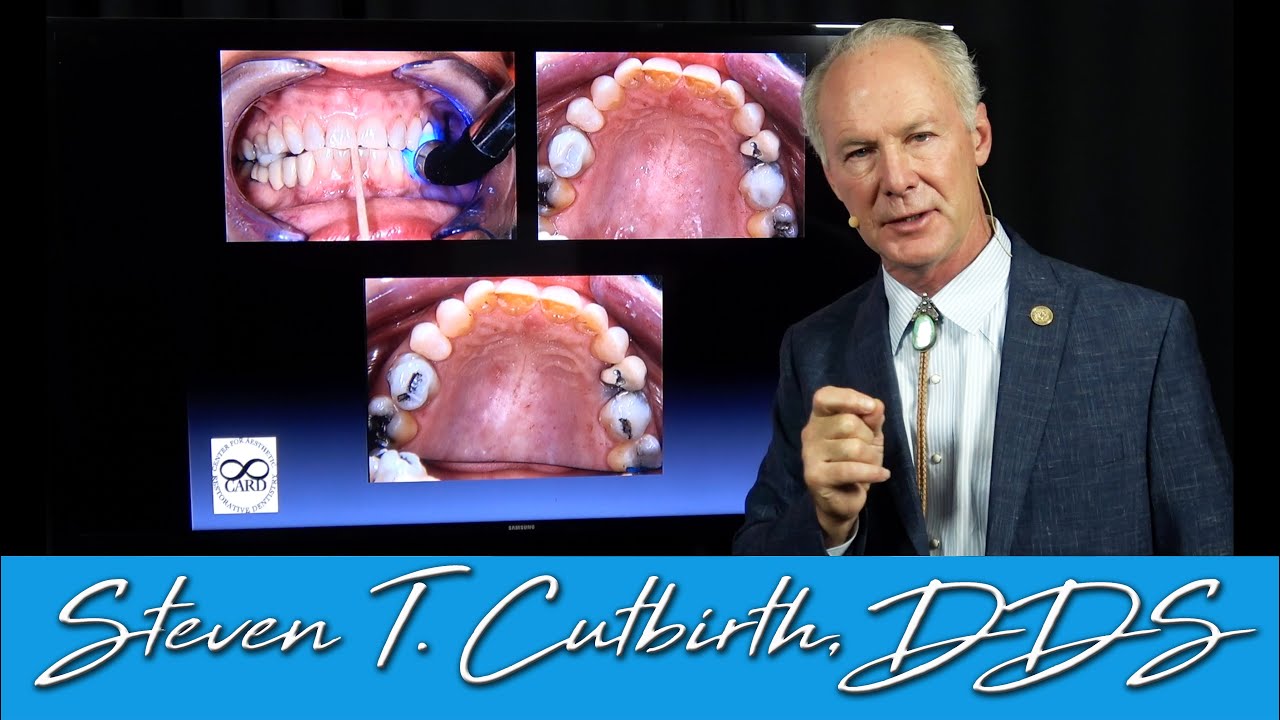 The Importance of a Comprehensive Exam on New Patients - Dental Minute with Steven T. Cutbirth, DDS