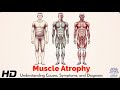 Muscle Atrophy Myths Busted: What’s Fact and What’s Fiction?
