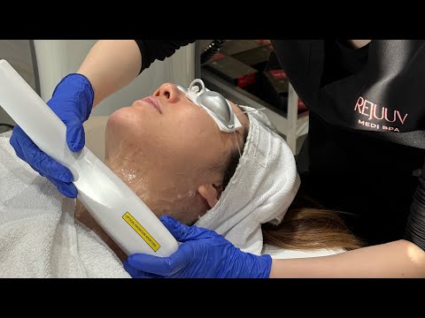 Rejuuv Medi Spa | Zaffiro Thermo-lifting