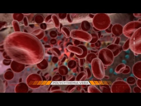 Behind the Mystery, Polycythemia Vera