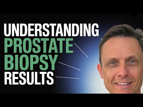 Prostate Biopsy Results Explained: A Patient’s Guide
