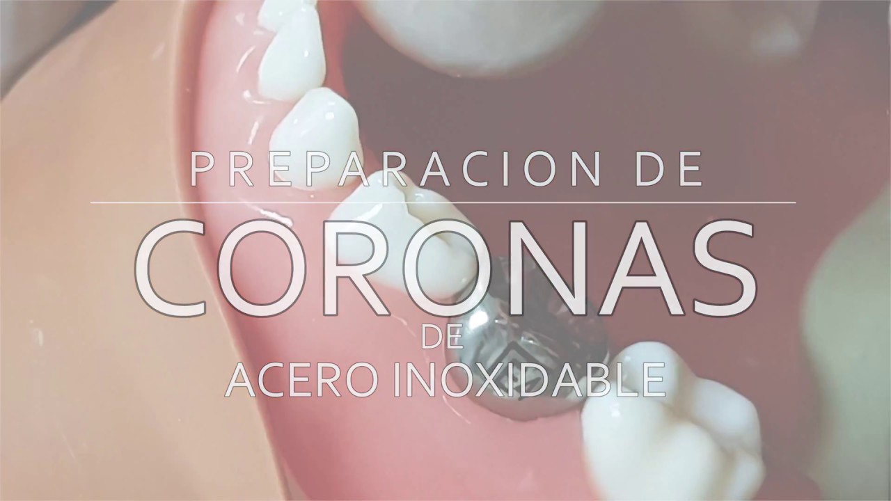 Watch Preparacion de Coronas de Acero Inoxidable Now Preparacion de Coronas de Acero Inoxidable
