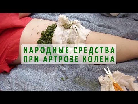 Отекли руки и ноги сильно болят суставы Боли в спине между лопаткой и тазом
