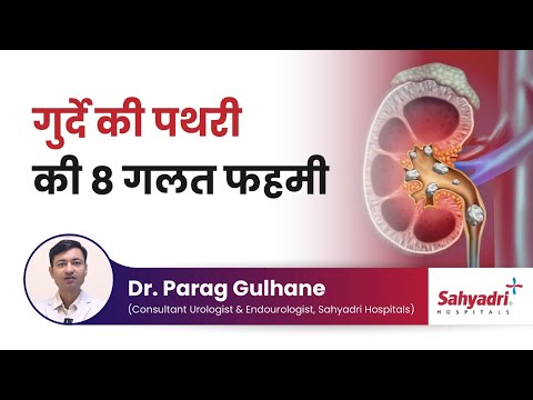 Kidney Stones | Misconceptions about kidney stones in Hindi | Dr Parag Gulhane