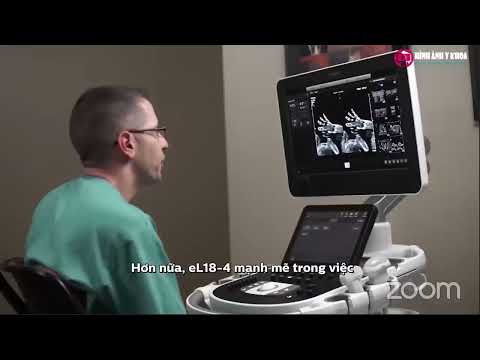 1.3 Giới thiệu giải pháp siêu âm sản phụ khoa của Philips