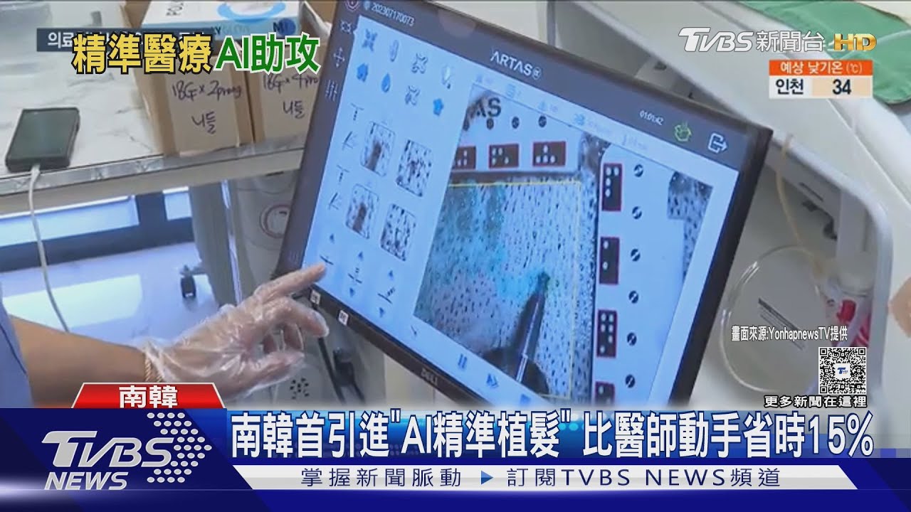 南韓首引進「AI精準植髮」 比醫師動手省時15%