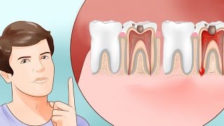 6 Home Remedies for Toothache That Really Work