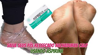 Salve seus pés das Rachaduras calo com Aspirina receita caseira PARA TER  Pés bebê