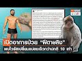 อาการ