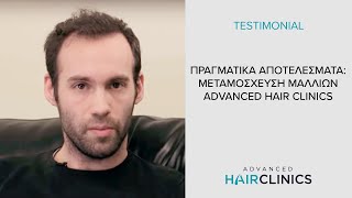 Αποτελέσματα Μεταμόσχευσης Μαλλιών Advanced FUE-από τον Δρ.Αναστάσιο Βεκρή