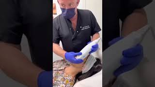 Ultherapy el lifting sin cirugía en Clínica Estética Médica Dermonova Málaga