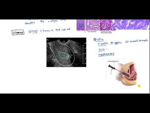 Kórokozó lenticum larg