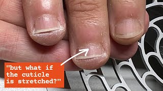Overgrown Skin Around the Nails | Simple Solution