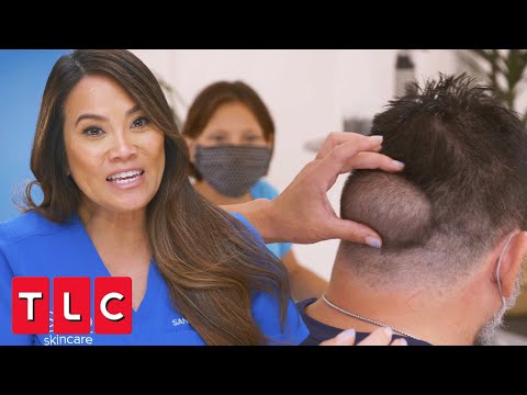 Ruben's Bump Has Been Growing For 16 Years! | Dr. Pimple Popper