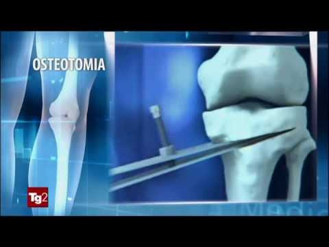Il dolore del cuore dalla parte posteriore Come trattare linfiammazione dellarticolazione temporo-mandibolare