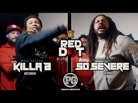 So Severe vs Killa B
