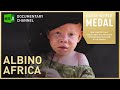 Documentary Society - Albino Africa