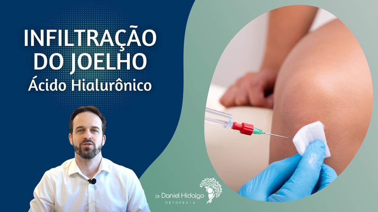 Infiltração do Joelho - Ácido Hialurônico