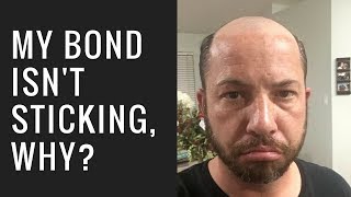 Hair Replacement Mens Hair System Review My bond isn't sticking, why?