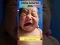 congenital absence of depressor angularis oris muscle |  #crying-baby #nicu  #shorts