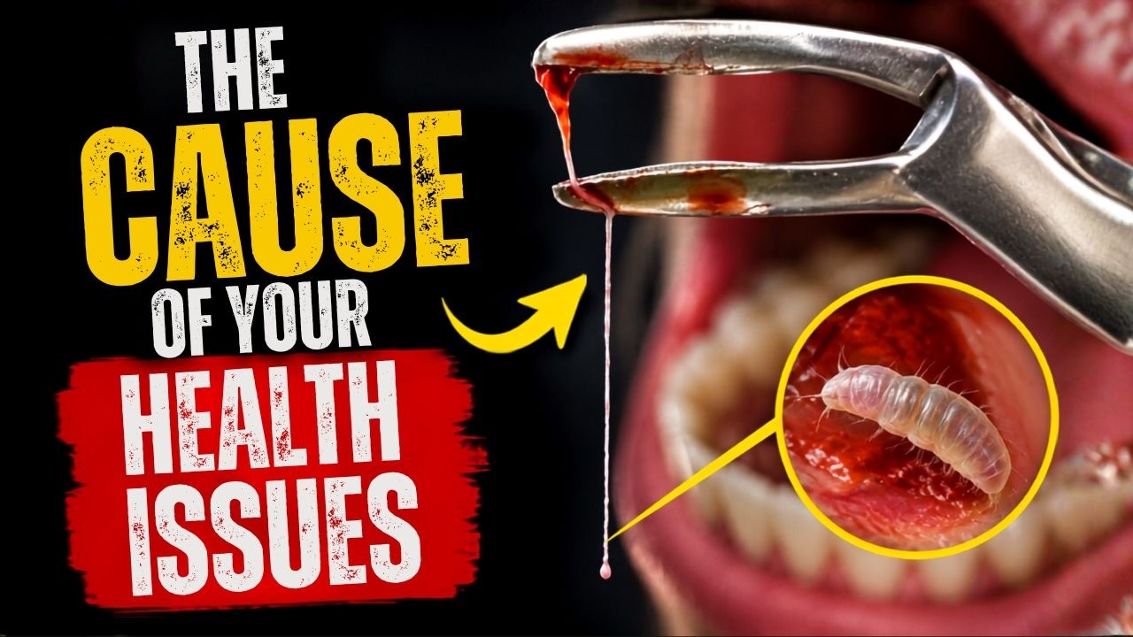 THE PARASITES AND POISONS HIDING IN YOUR MOUTH