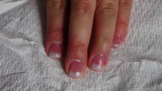 Acrylic Nails: Short Pink and White Glitter Nails