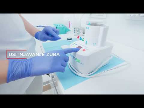 Zubni implantati inozemni pacijenti - Stomatološka poliklinika | Stomatološka poliklinika Zagreb | Štimac centar dentalne medicine