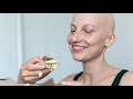 Sarcoma Cancer Care | Support That Makes a Difference - Pamela Goetz, OPN-CG