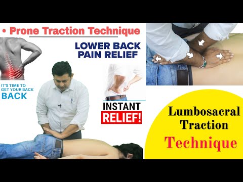 Low back pain due to stiff sacroiliac joint Try Pelvic drop home exercise for quick relief