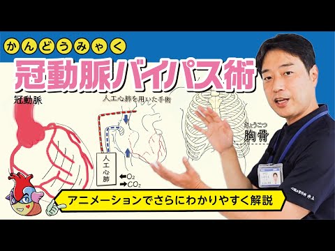 冠動脈バイパス移植術 - 定義