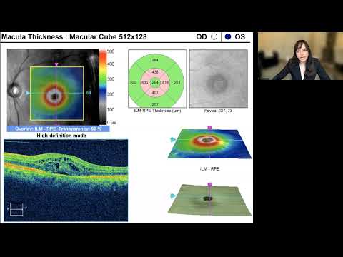 Lecture: Red, Green, and Yellow Disease: OCT Artifacts in Retinal Imaging