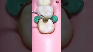 Download lagu Perfect Cavity Filling #Satisfying #asmr mp3