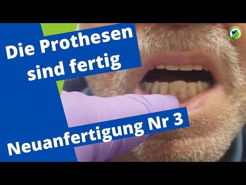 Neue Prothesen - Sprechprobe, perfekter Saugeffekt Totalprothese, Okklusion, Remontage, Tipps Tricks
