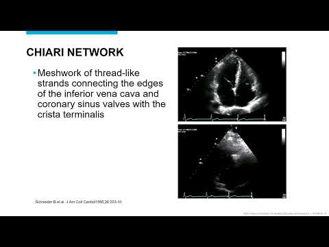 Simple Congenital Heart Disease | Mayo Clinic Echo 2024