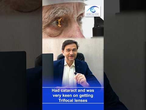 AI-Designed Trifocal Lenses for Cataract Surgery in India: Achieving Clear Vision Without Halos