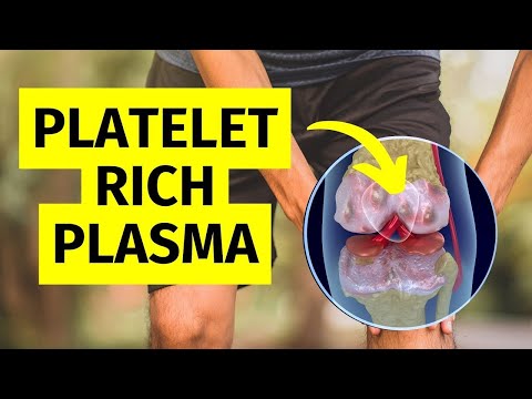 Die Wahrheit über PRP-Injektionen bei Kniearthrose: Was Sie wissen müssen