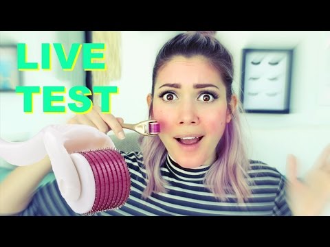 540 Nadeln im Gesicht😱 Dermaroller im Live Test | funnypilgrim