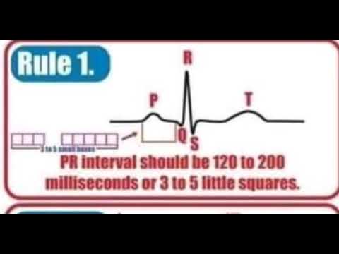 EKG/ECG basic  lesson #1(10 rules of normal ekg)