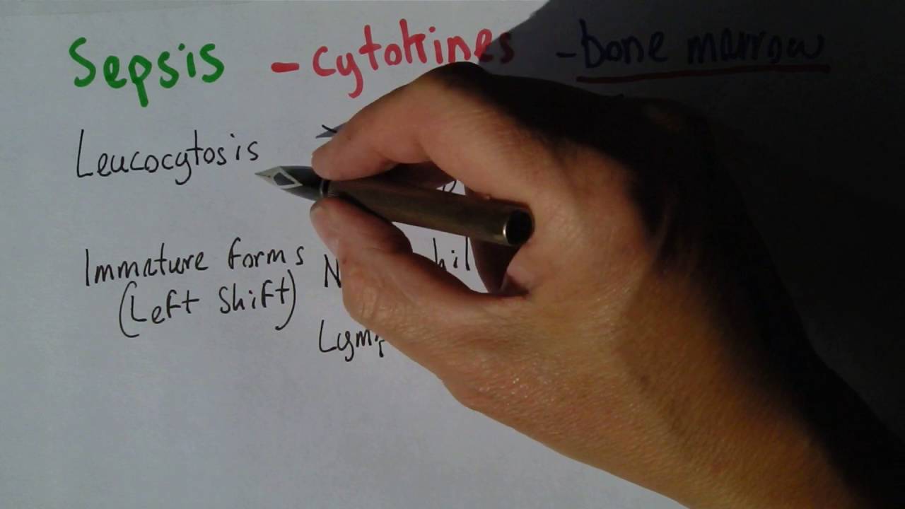 Sepsis 2, White cell response