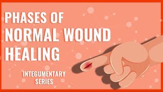 Phases of Normal Wound Healing