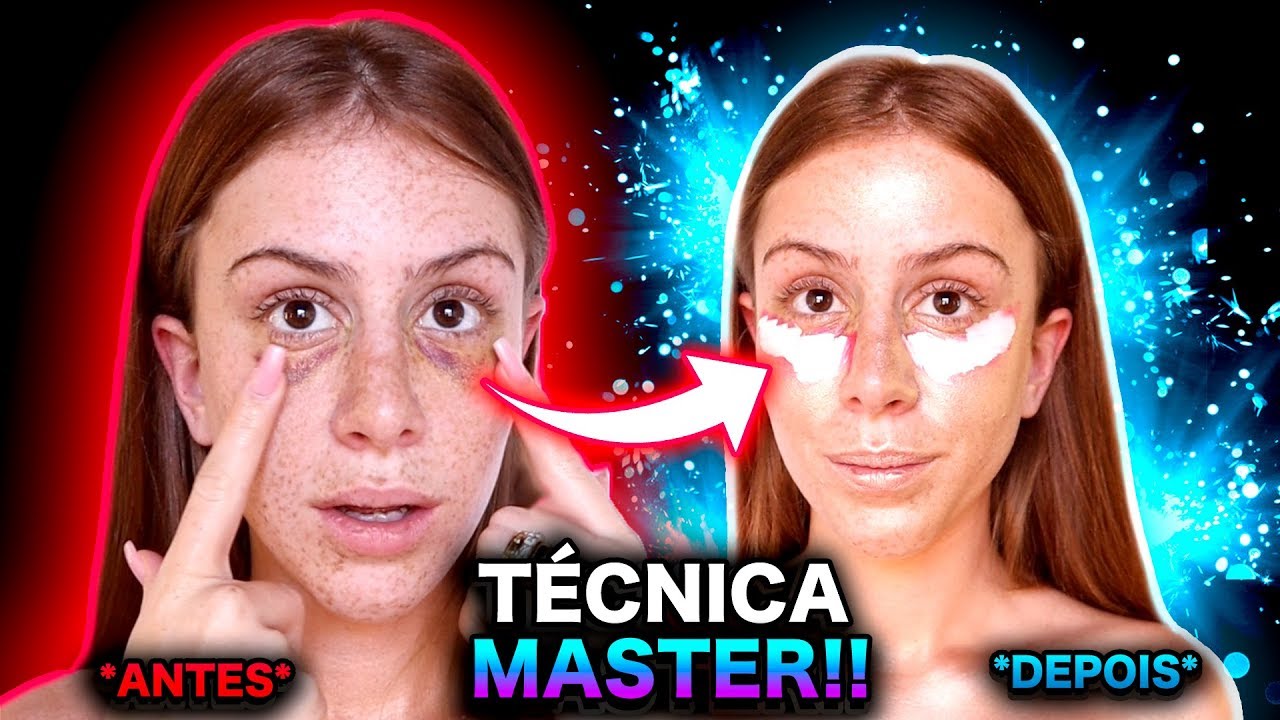 Como *ESCONDER* HEMATOMAS de Procedimentos Estéticos! 🔥🔥🔥