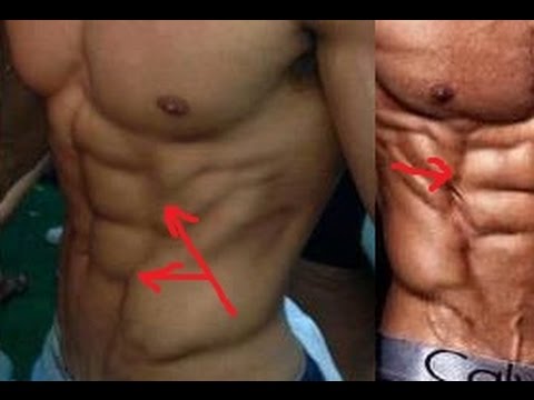Piriformis w jodze Zatrucie ból w mięśniach łydek