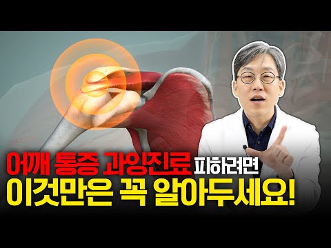 회전근개 파열 꼭 수술해야 할까?