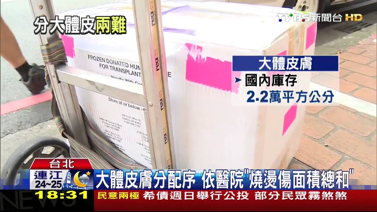 大體皮膚分配序　依醫院「燒燙傷面積總和」