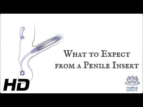 Herpes Simplex Causes Signs and Symptoms Diagnosis and Treatment