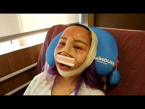 Watch lagu Images Videos Famous Plastic Surgery Clinic In Korea, Watch Images Famous Plastic Surgery Clinic In Korea free Watch, Watch Images Famous Plastic Surgery Clinic In Korea