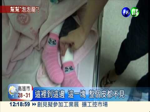 7歲女罹泡泡龍症 母"愁"醫藥費