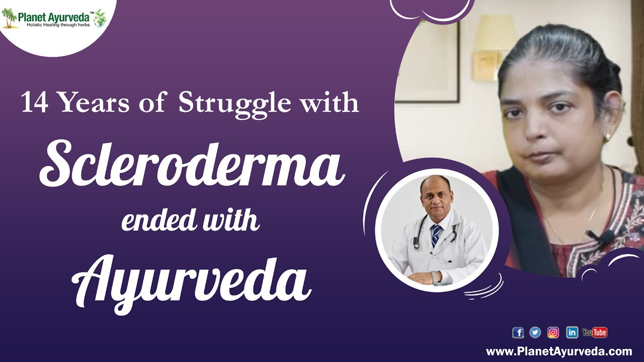 How to Cure Scleroderma? - 14 Years of Struggle with Scleroderma ended with Ayurveda - YouTube